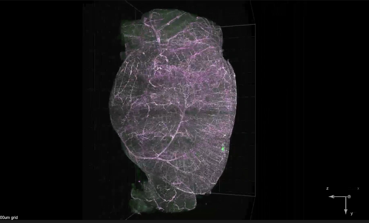 3D vascular network rendering of a mouse brain